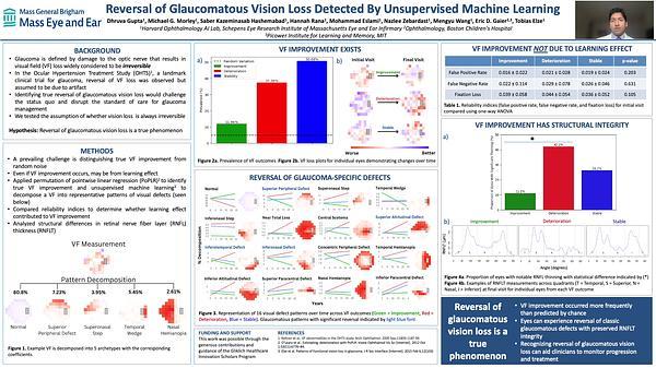 Reversal of Glaucomatous Vision Loss Detected By Unsupervised Machine Learning