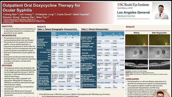 Outpatient Oral Doxycycline Therapy for Ocular Syphilis