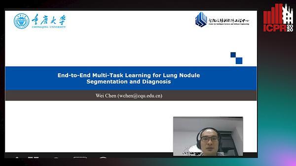 End-to-End Multi-Task Learning for Lung Nodule Segmentation and Diagnosis