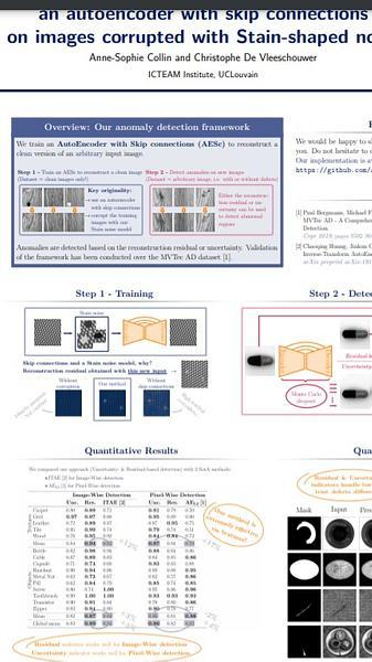 Improved anomaly detection by training an autoencoder with skip connections on images corrupted with Stain-shaped noise