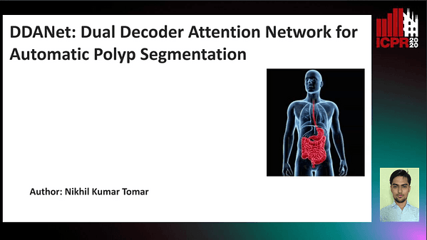 DDANet: Dual Decoder Attention Network for Automatic Polyp Segmentation