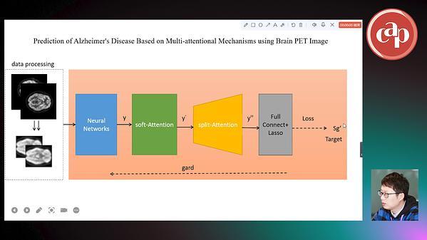 Prediction of Alzheimer's Disease Based on Multi-Attentional Mechanisms using Brain PET Image