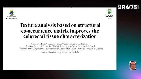 Texture analysis based on structural co-occurrence matrix improves the colorectal tissue characterization