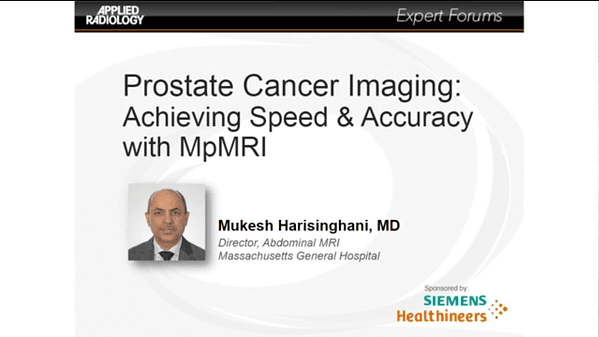 Prostate Cancer Imaging: Achieving Speed & Accuracy with MpMRI