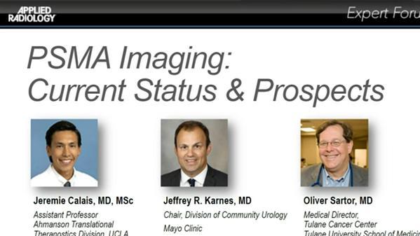 PSMA Imaging: Current Status & Prospects