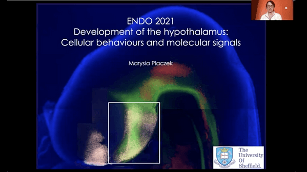 Development of the Hypothalamus: Cellular Behaviours and Molecular Signals