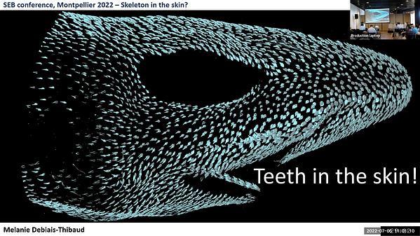 Skeleton in the skin? Teeth in the skin!