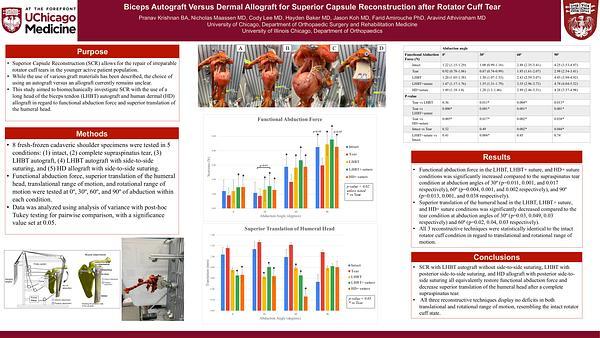 Orthopaedic Surgery - Biceps Autograft versus Dermal Allograft for Superior Capsule Reconstruction after Rotator Cuff Tear - Orthopaedic Surgery