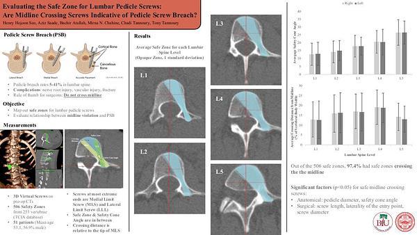 Evaluating the Safe Zone for Lumbar Pedicle Screws: Are Midline Crossing Screws Indicative of Pedicle Screw Breach?