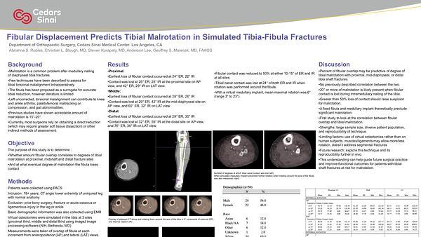Fibular Displacement Predicts Tibial Malrotation in Simulated Tibia-Fibula Fractures