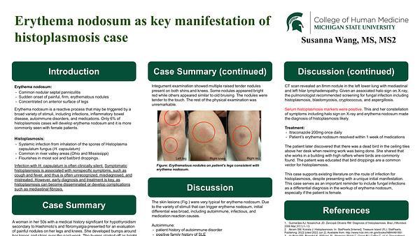 Erythema Nodosum as Key Manifestation of Histoplasmosis Case