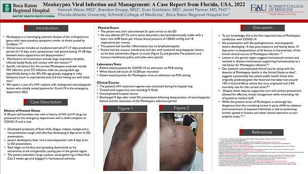 Monkeypox Viral Infection and Management: A Case Report from Florida, USA, 2022