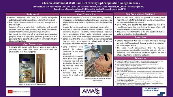 Chronic Abdominal Wall Pain Relieved by Sphenopalatine Ganglion Block