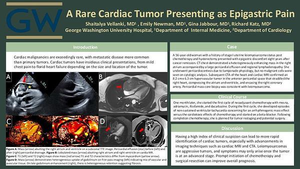 A Rare Cardiac Tumor Presenting as Epigastric Pain