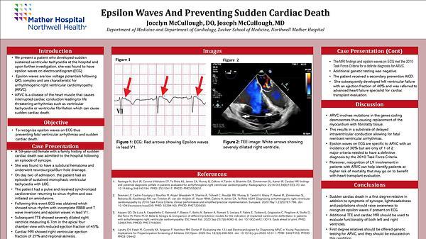 Epsilon Waves and Preventing Sudden Cardiac Death
