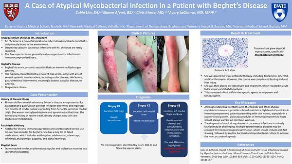 A Case of Atypical Mycobacterial Infection in a Patient with Bechet's Disease