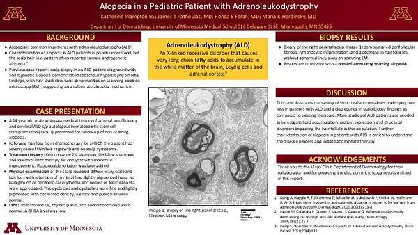Alopecia in a Pediatric Patient with Adrenoleukodystrophy