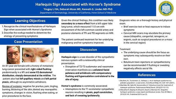 Harlequin Sign Associated with Horner's Syndrome