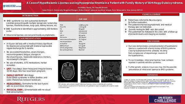 A Case of Hypothalamic Lipoma causing Hyperprolactinemia in a Patient with Family History of Birt-Hogg-Dubé syndrome.​