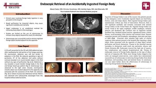 Endoscopic Retrieval of an Accidentally Ingested Foreign Body