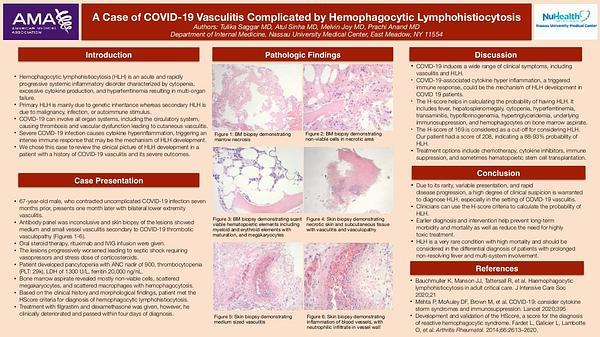 A Case of COVID-19 Vasculitis Complicated by Hemophagocytic Lymphohistiocytosis