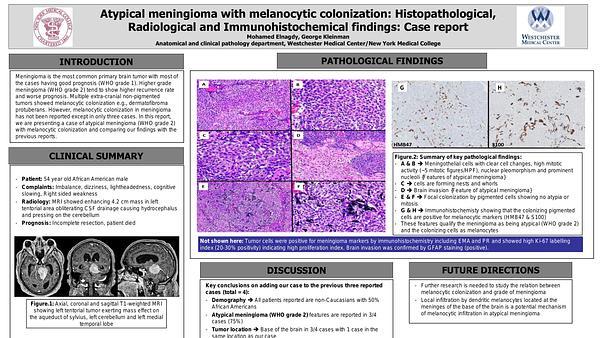Atypical meningioma with melanocytic colonization: Histopathological, Radiological and Immunohistochemical findings
