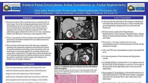 Bilateral Renal Oncocytoma: Active Surveillance vs. Partial Nephrectomy