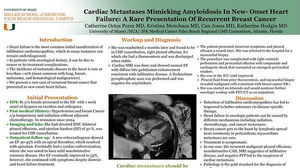 Cardiac Metastases Mimicking Amyloidosis In New- Onset Heart Failure: A Rare Presentation Of Recurrent Breast Cancer 