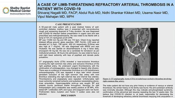 A Case of Limb-threatening Refractory Arterial Thrombosis in a Patient With Covid-19
