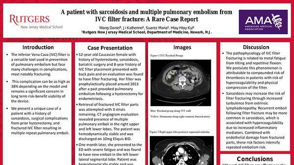 A patient with sarcoidosis and multiple pulmonary embolism from IVC filter fracture: A Rare Case Report