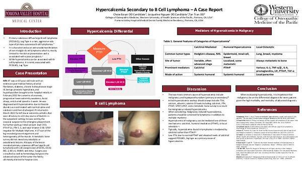Hypercalcemia Secondary to B Cell Lymphoma – A Case Report