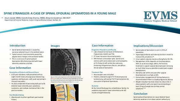 Spine strangler: A case of spinal epidural lipomatosis in a young male