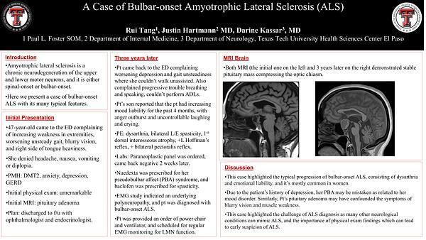 A Case of Bulbar-onset Amyotrophic Lateral Sclerosis (ALS)