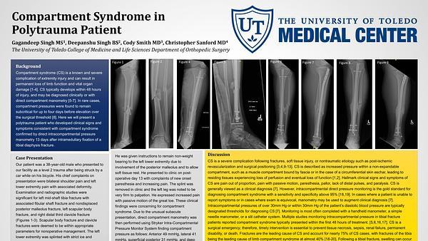 Compartment Syndrome in Polytrauma Patient