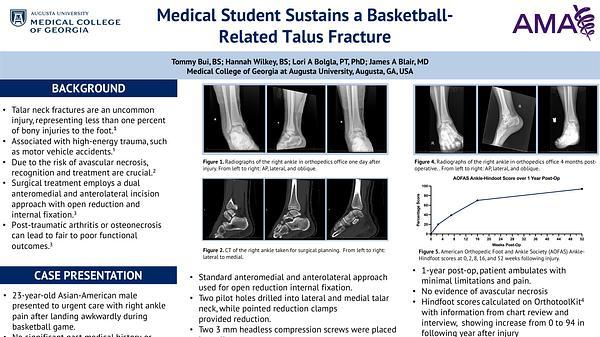 Medical Student Sustains a Basketball-Related Talus Fracture