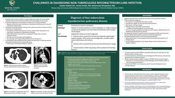 Challenges in diagnosing non-tuberculosis mycobacterium lung infections