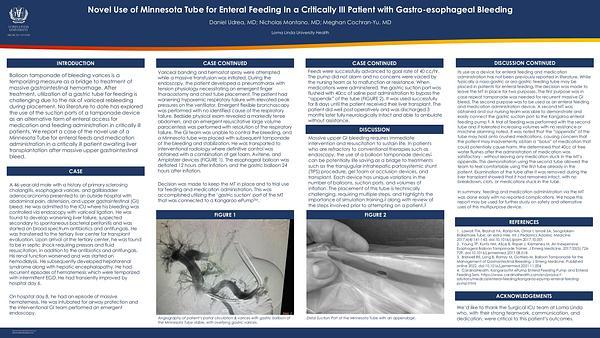Novel Use of Minnesota Tube for Enteral Feeding In a Critically Ill Patient with Gastro-esophageal Bleeding