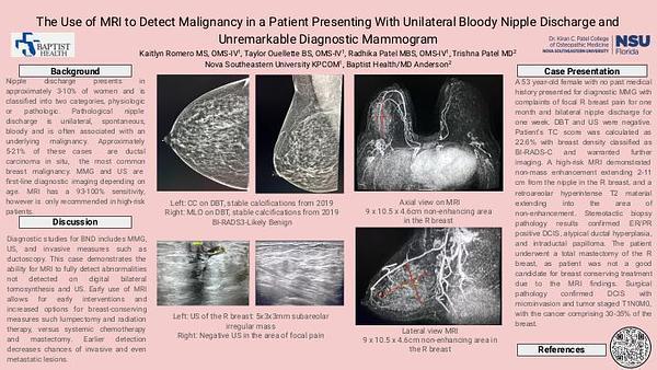 The Use of MRI to Detect Malignancy in a Patient Presenting With Unilateral Bloody Nipple Discharge and Unremarkable Diagnostic Mammogram