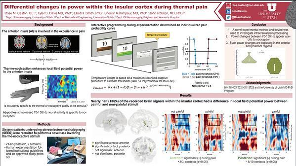 Differential changes in power within the insular cortex during thermal pain
