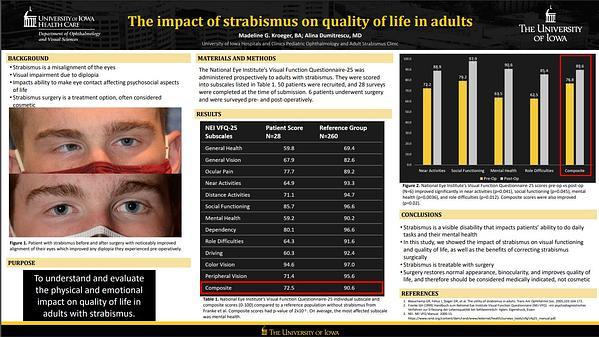 The impact of strabismus on quality of life in adults
