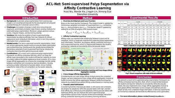 ACL-Net: Semi-supervised Polyp Segmentation via Affinity Contrastive Learning