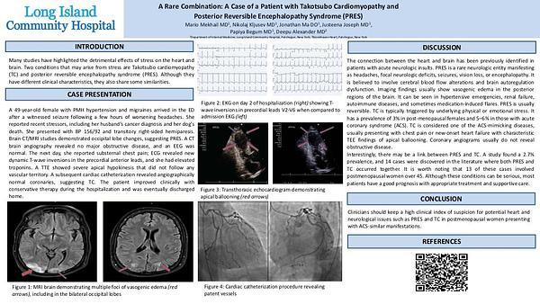 A Rare Combination: A Case of a Patient with Takotsubo Cardiomyopathy and 
Posterior Reversible Encephalopathy Syndrome (PRES)