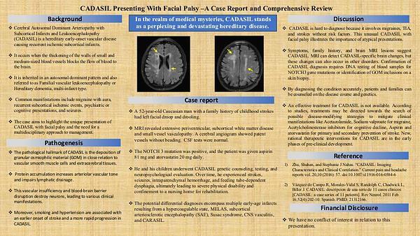 CADASIL Presenting With Facial Palsy –A Case Report and Comprehensive Review
