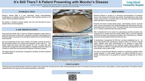 It's still there? A patient presenting with Mondor's disease