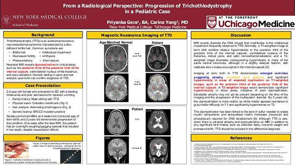 From a Radiological Perspective: Progression of Trichothiodystrophy
in a Pediatric Case