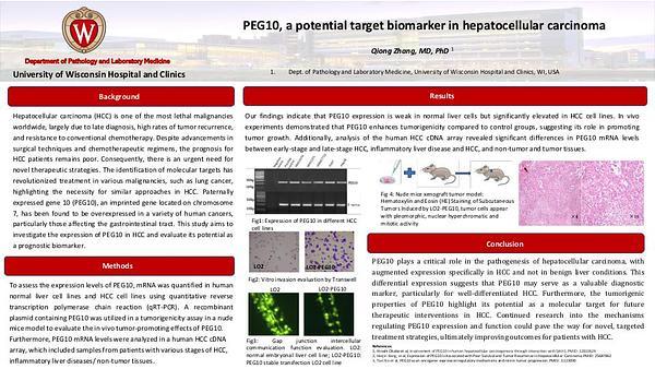 PEG10, a potential target biomarker in hepatocellular carcinoma