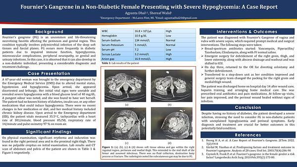 Fournier’s Gangrene in a Non-Diabetic Female Presenting with Severe Hypoglycemia: A Case Report
