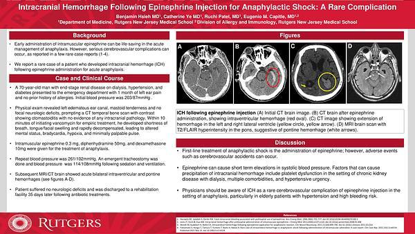 Intracranial Hemorrhage Following Epinephrine Injection for Anaphylactic Shock: A Rare Complication