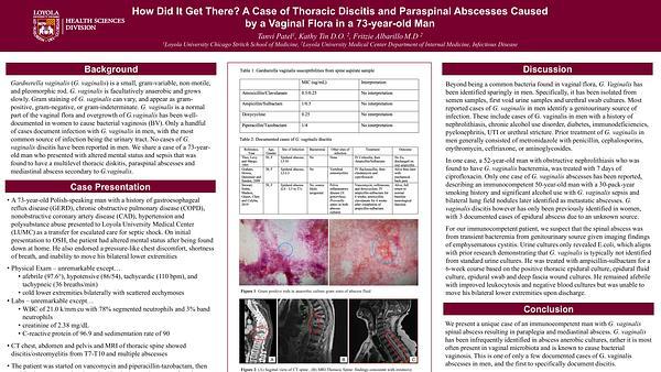 How Did It Get There? A Case of Thoracic Discitis and Paraspinal Abscesses Caused by a Vaginal Flora in a 73-year-old Man