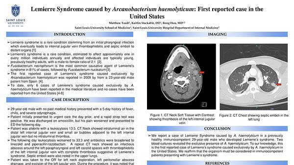 Lemierre Syndrome caused by Arcanobacterium haemolyticum: First reported case in the United States